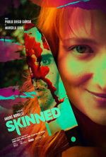 Watch Skinned 0123movies