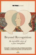 Watch Beyond Recognition: The Incredible Story of a Face Transplant 0123movies