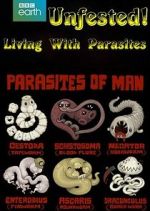 Watch Infested! Living with Parasites 0123movies